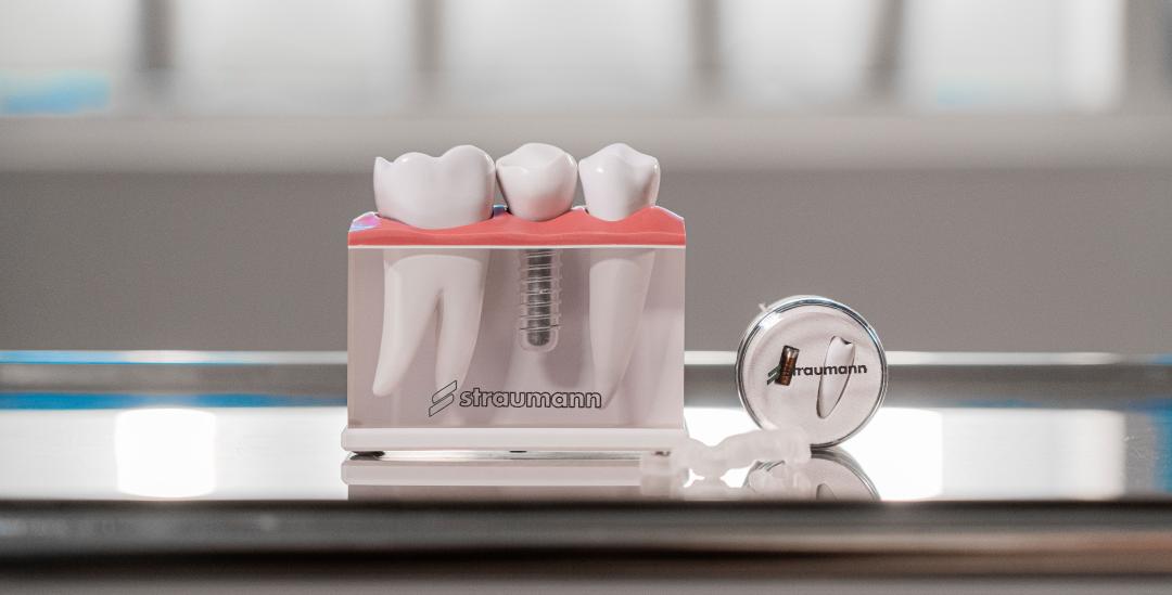 PlusTerveys Rytivaara puuttuvan hampaan korvaaminen implantilla