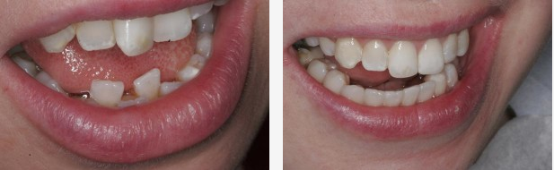 PlusTerveys Smile Design Hampaat 18