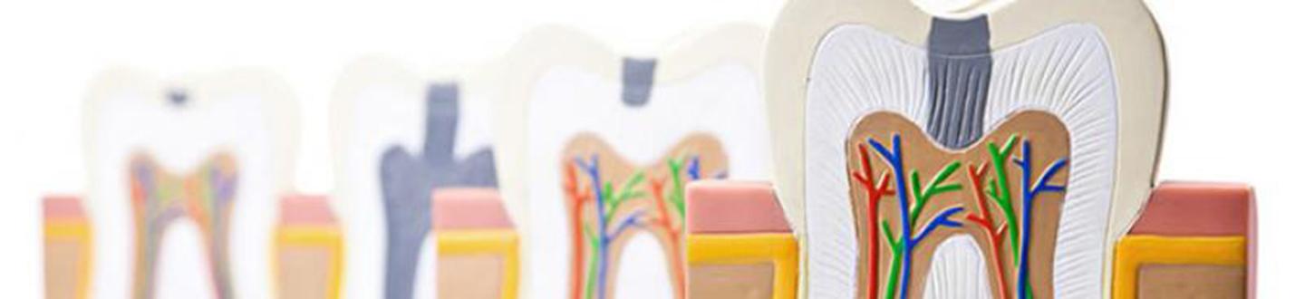 Hampaiden juurihoito PlusTerveys